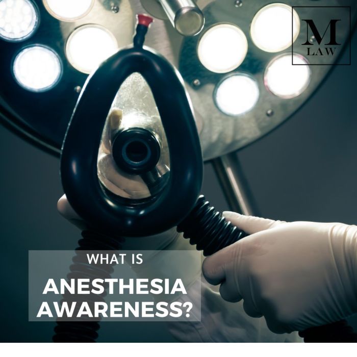 What Is Anesthesia Awareness? - Merson Law PLLC